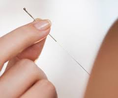 Akupunktūra: gydymas adatų bakstelėjimais